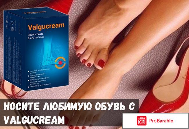 Valgucream (Вальгукрем) реальные отзывы