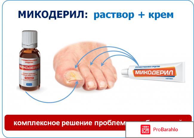 Отзывы цена микодерил обман
