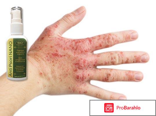 Anti psori nano отрицательные отзывы