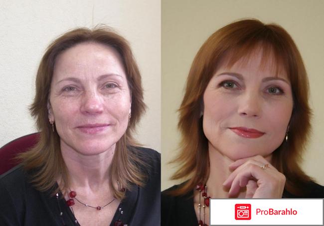 BIOFILLER низкомолекулярная сыворотка отрицательные отзывы