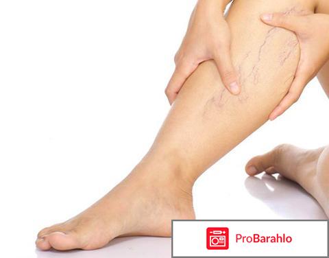 Почему нельзя класть ногу на ногу? отрицательные отзывы