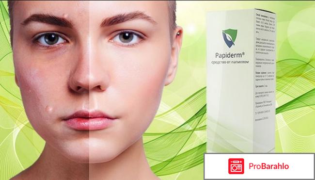 Papiderm от папиллом 