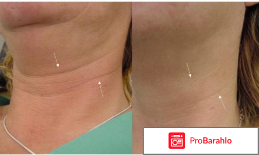 Специальный уход Косметическое масло Bio-Oil Bio-Oil 