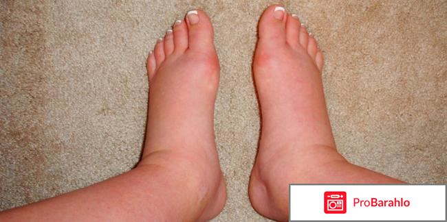 Тригрим инструкция по применению цена отзывы