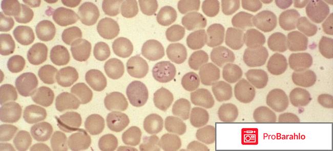 Бабезиоз у человека симптомы и лечение отрицательные отзывы