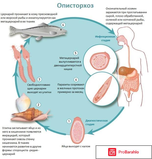Описторхоз симптомы обман