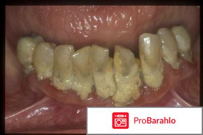 Air flow чистка 