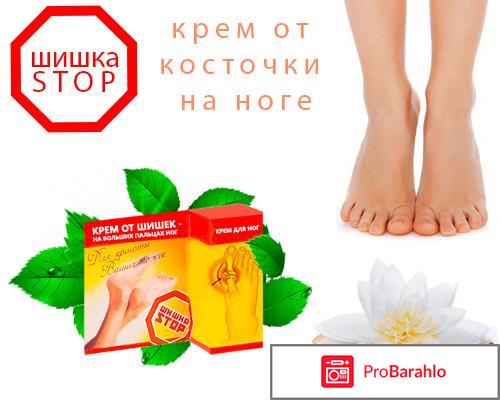 Крем `Шишка Стоп`: отзывы, цена, где купить отрицательные отзывы