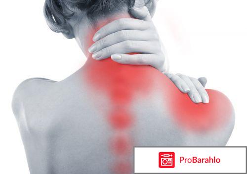 Синдром цервикокраниоалгии позвоночной артерии 