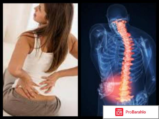 Мовалис отзывы врачей 