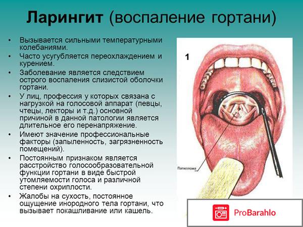 Чем лечить ларингит 