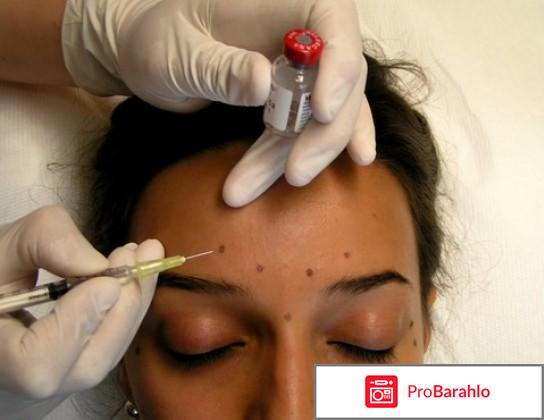 Ботокс купить в аптеке цена отзывы владельцев