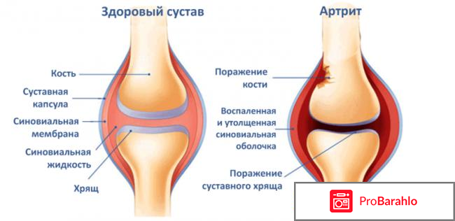 ТЕРАФЛЕКС капсулы обман