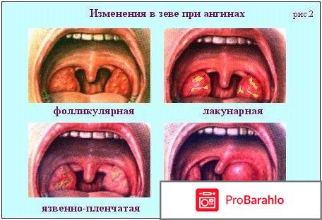 ЛИЗОБАКТ таблетки 