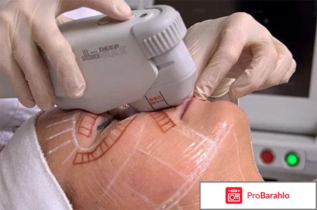 Альтера систем отзывы отрицательные