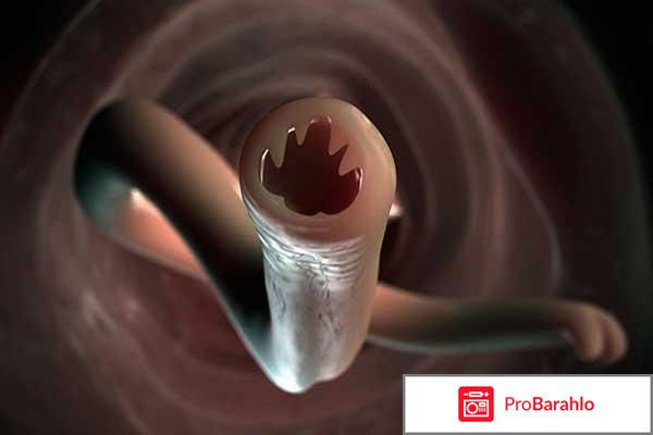 Немозол отзывы паразитологов 