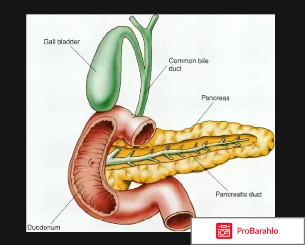 Холецистопанкреатит лечение отрицательные отзывы