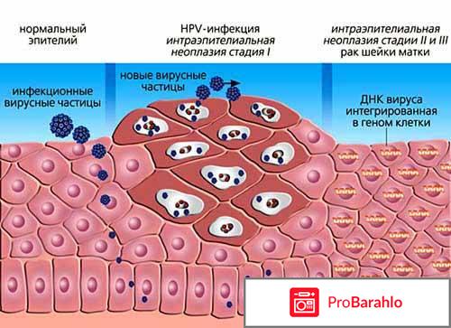 Клареол 