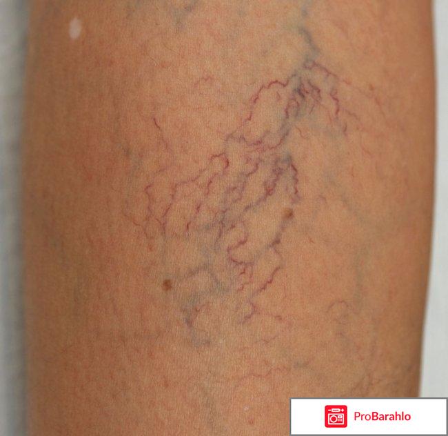 Отзывы веномазь фитомакс отрицательные отзывы