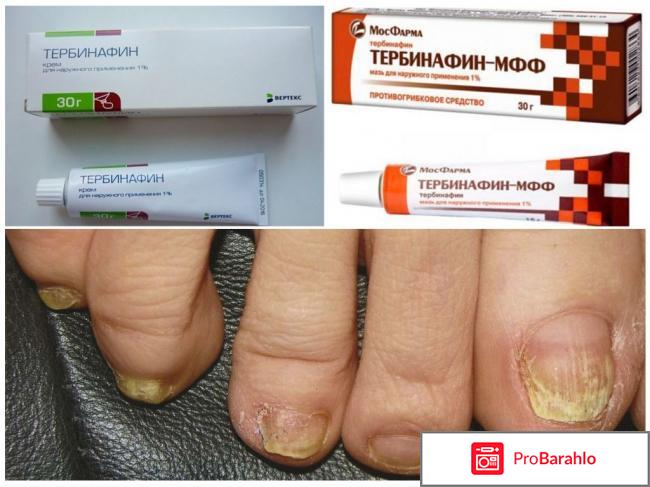 Тербинафин мазь цена отзывы отрицательные отзывы