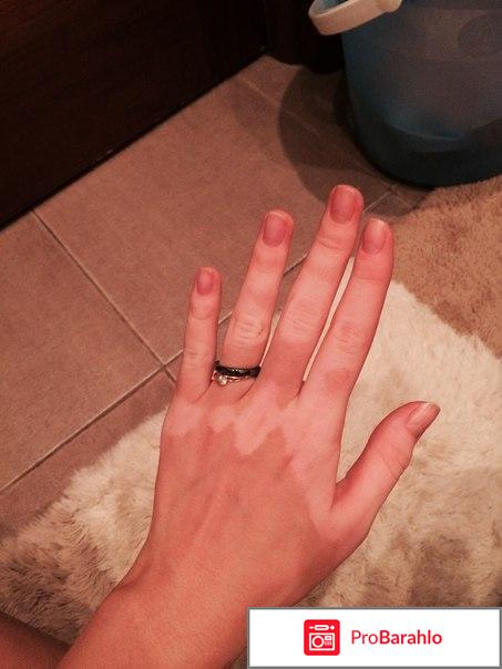 Кто-нибудь излечился от витилиго отрицательные отзывы