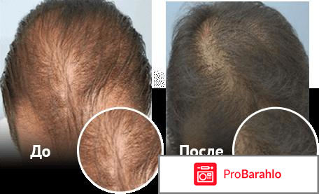 PROFOLAN отрицательные отзывы