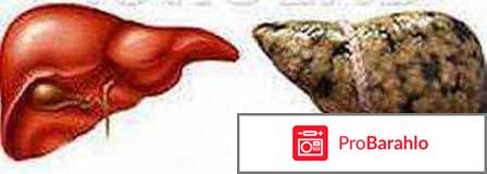 Отзывы врачей гептрал 