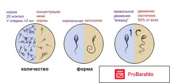 Олигоспермия 