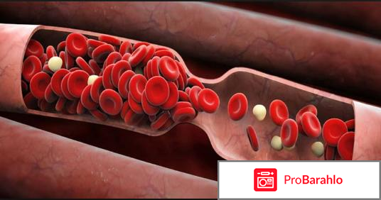 Ксарелто отзывы врачей 