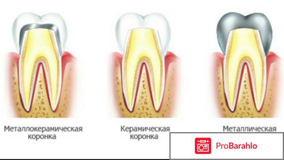 Стоматологии хабаровска отрицательные отзывы