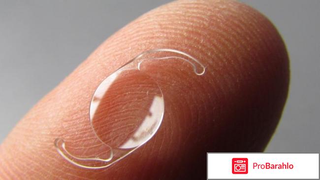 Искусственный хрусталик какой лучше отзывы цены отрицательные отзывы