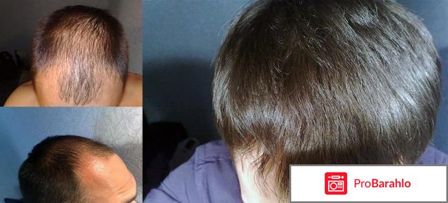 Если не помогает генеролон обман