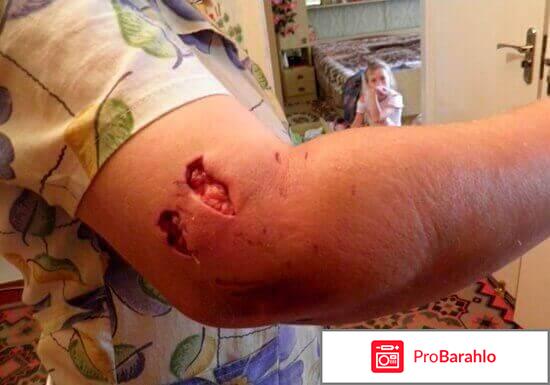 Рваная рана при укусе собаки обман