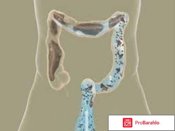 Refresh от шлаков и токсинов 