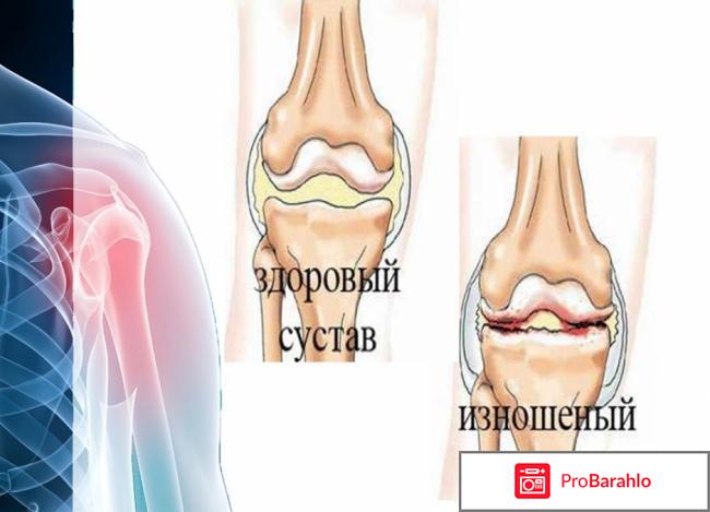 TibeTTea - тибетский чай для суставов обман
