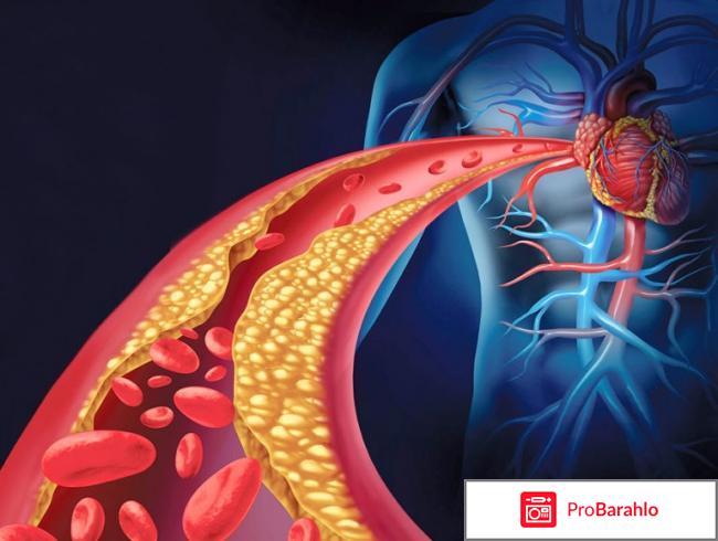 Чистка сосудов в домашних условиях отрицательные отзывы