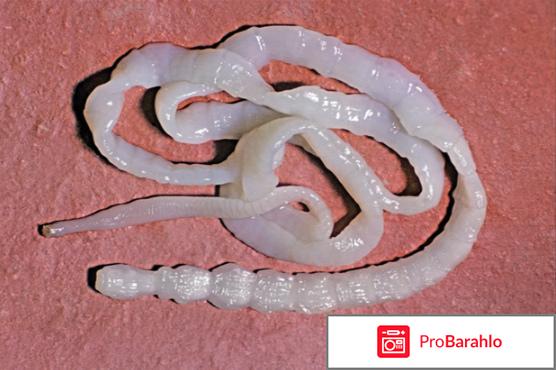 Свиной цепень вызывает заболевание 