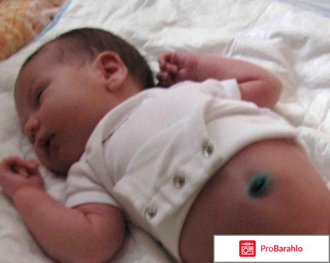 Использование газоотводной трубкb для новорожденных обман