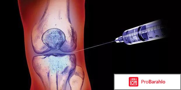 Гиалуроновая кислота для суставов обман