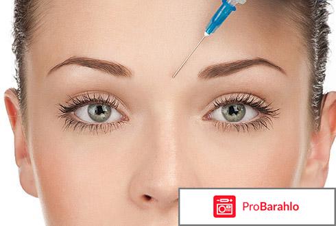 Диспорт фото до и после фото