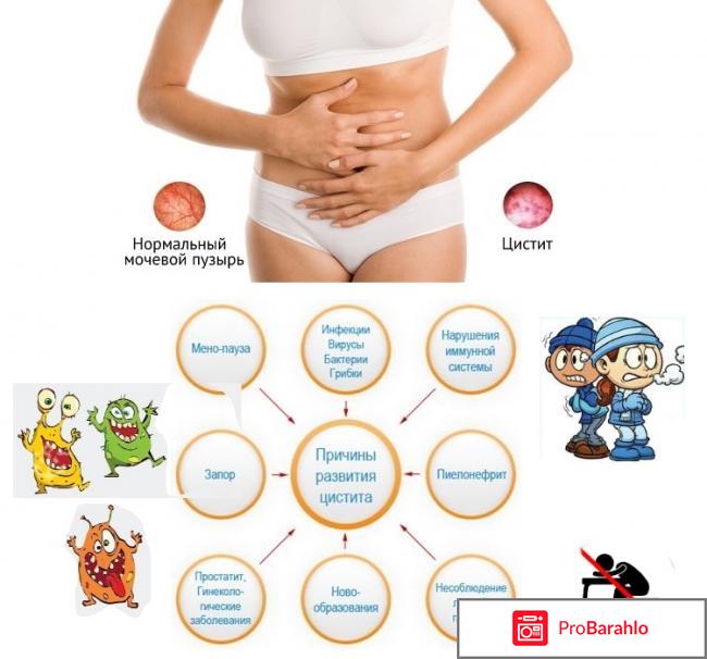 Секстафаг от цистита у женщин отрицательные отзывы