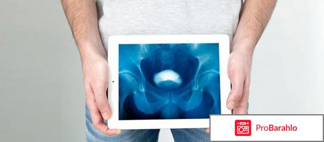 Сенаторов иван александрович обман