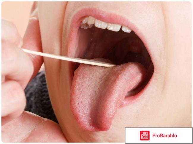 Трахисан отзывы отрицательные отзывы