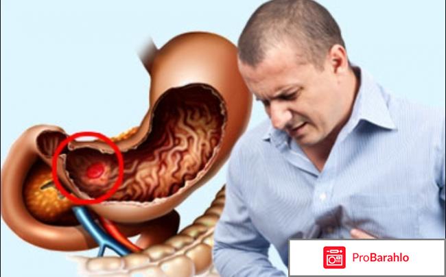 Де нол инструкция по применению цена отзывы отрицательные отзывы