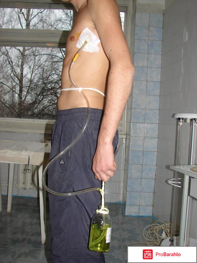 Абдулин ринат юратович положительные отзывы отрицательные отзывы