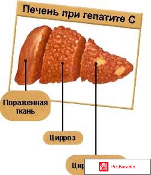 Daclavirocyrl реальные отзывы