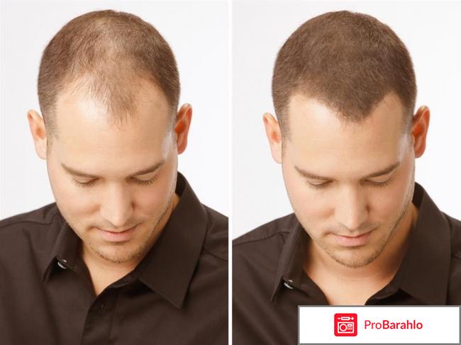 Загуститель волос 