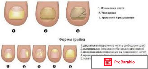 Отзывы номидол от грибка отрицательные отзывы