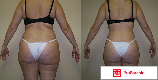 Нозоми массажер мн-103 обман