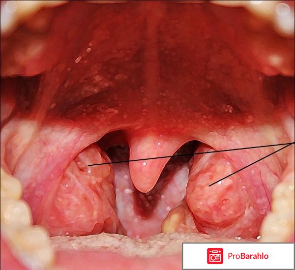 Ферматрон инструкция по применению цена уколы отрицательные отзывы